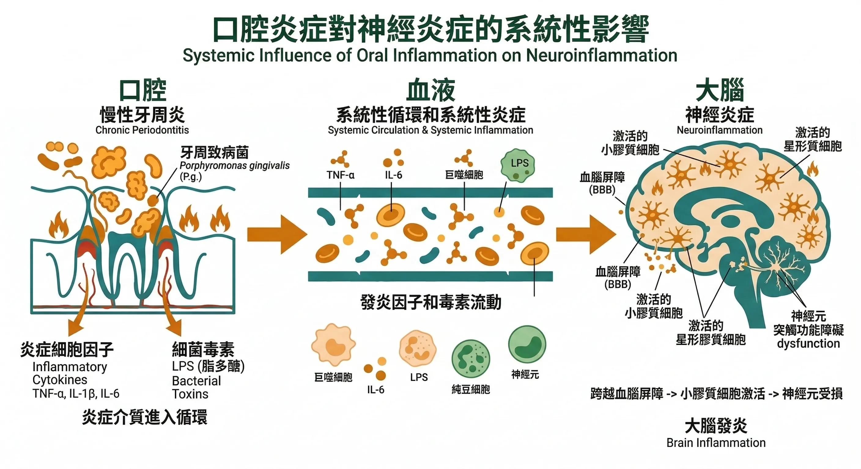 口腔-血液-大腦發炎路徑示意圖