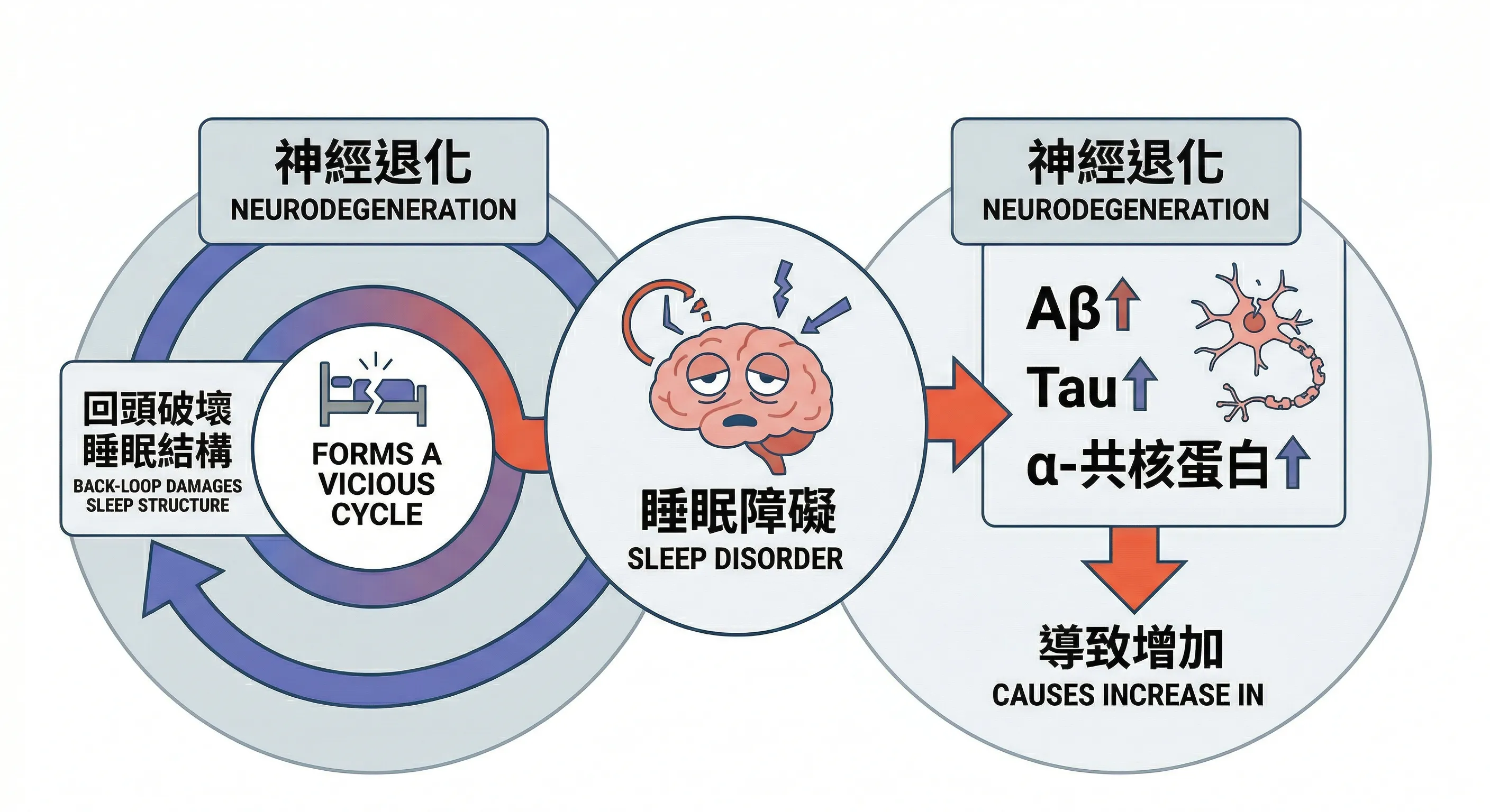 睡眠障礙與神經退化關係圖